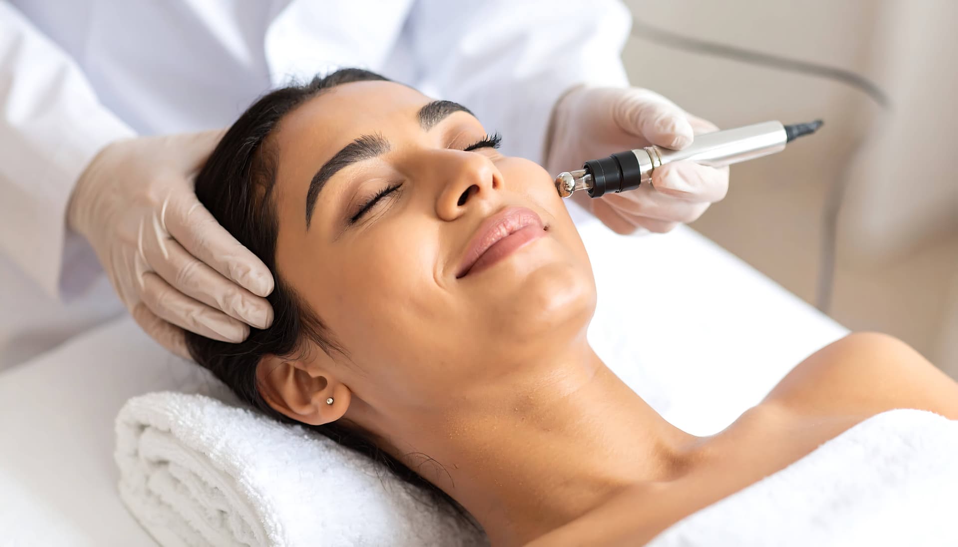 Microneedling